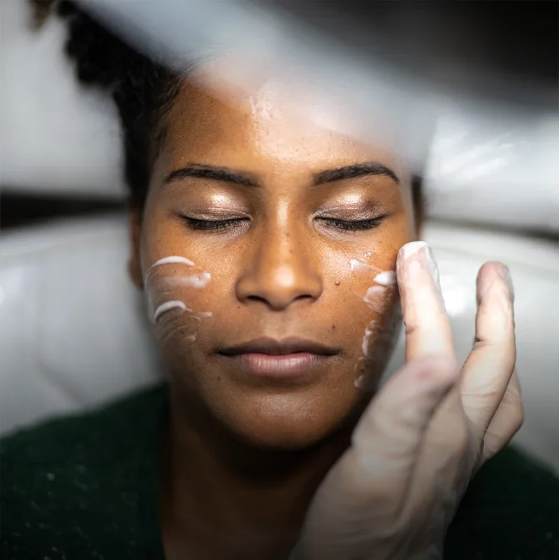 skin-chemical-peels