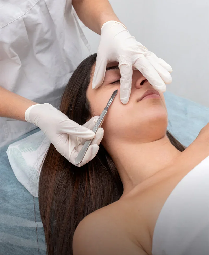 skin-dermaplaning