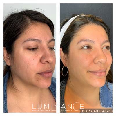 EmfacePotenza2b