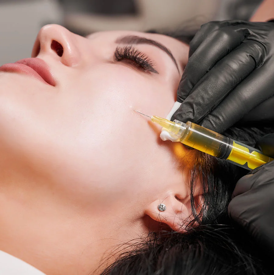 A close-up shot of a woman's face during an aesthetic procedure. A medical professional, wearing black gloves, is administering an injection into the woman's cheek near her earlobe using a syringe containing a yellow substance, likely a platelet-rich fibrin (PRF) or similar gel. The woman's eyes are closed, and she is lying down. - EZ Gel PRF Benefits in San Jose, CA